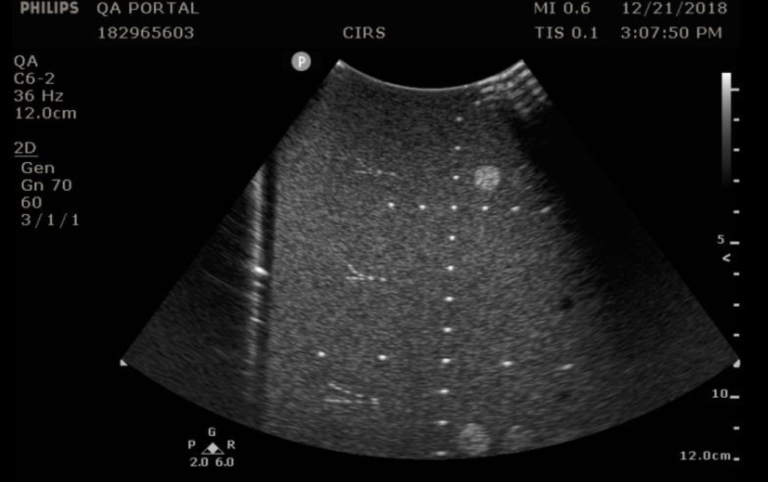 General Purpose Ultrasound Phantom - CIRS Product Support